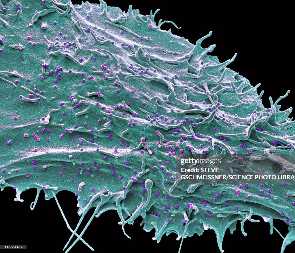 SIV infected cell, SEM