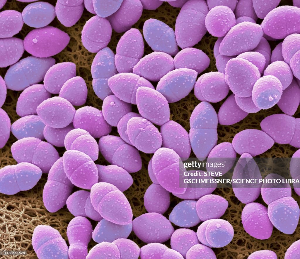 Kefir bacteria, SEM