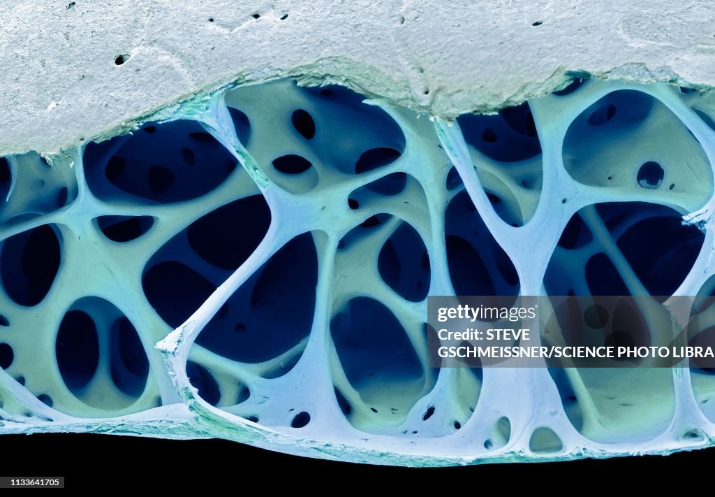 Bird bone tissue, SEM