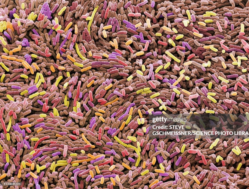 Ecoli bacteria, SEM