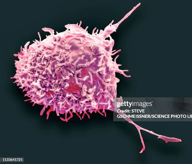 mesenchymal stem cell, sem - lymphoma stock illustrations