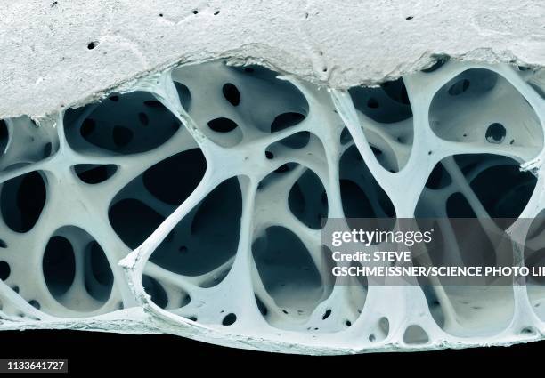 ilustraciones, imágenes clip art, dibujos animados e iconos de stock de bird bone tissue, sem - hueso