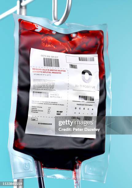 hospital blood bag on stand in er - plasma stockfoto's en -beelden