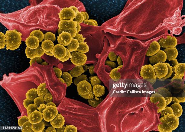 staphylococcus aureus and a dead human neutrophil - vergroting stockfoto's en -beelden