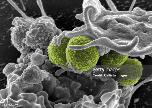 mrsa, staphylococcus aureus bacteria - staphylococcus stock pictures, royalty-free photos & images