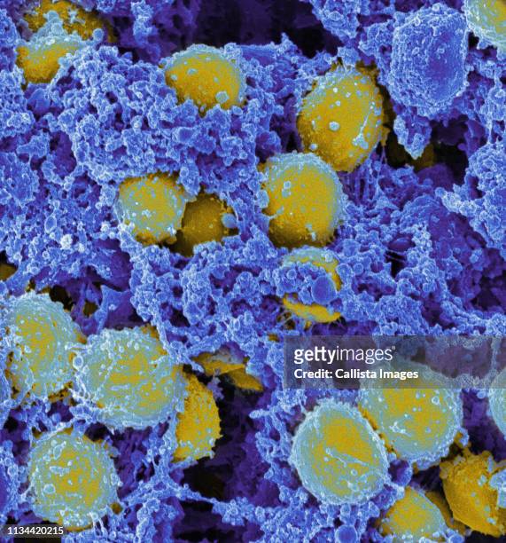 staphylococcus aureus - estafilococo fotografías e imágenes de stock