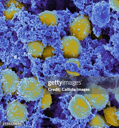 Staphylococcus aureus Staphylococcus aureus