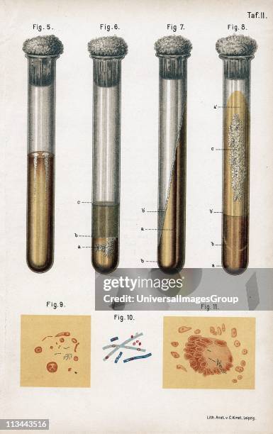 Pneumonia culture. 6 Albumen from rotten egg. 7& 8:Tuberculosis as prepared by Koch. 9:Sputum from TB patient. 10: Anthrax bacillus. 11:TB bacillus...