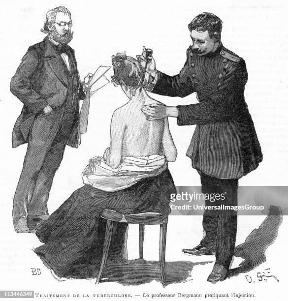 Professor Bergmann injecting a tubercular patient, 1891. Bergmann assisted Robert Koch in investigations on treatment of Tuberculosis. In 1890 Koch...