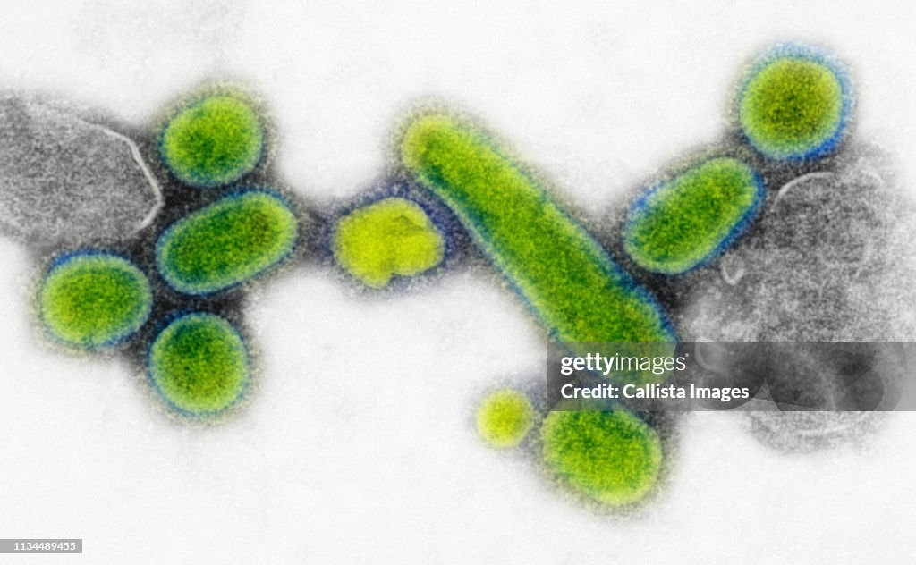 TEM of 1918 influenza virus