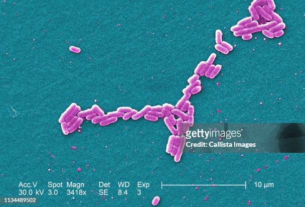 sem of e. coli o157:h7 - 大腸菌 ストックフォトと画像