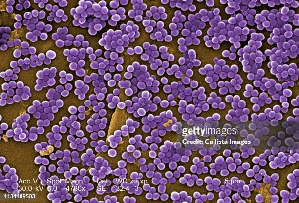 sem of methicillin-resistant staphylococcus aureus - estafilococo fotografías e imágenes de stock