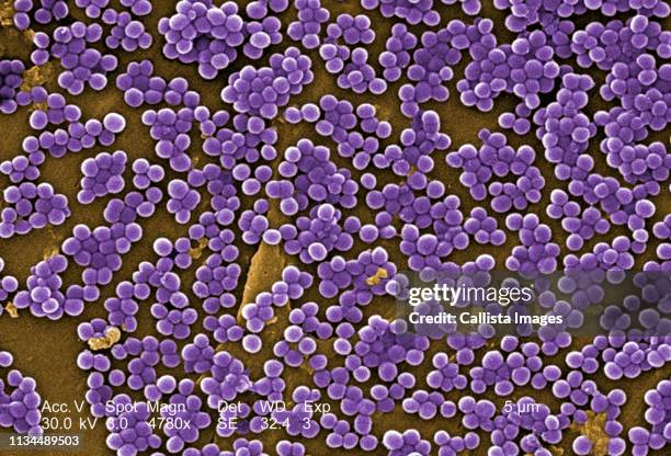 sem of methicillin-resistant staphylococcus aureus - mrsa bildbanksfoton och bilder