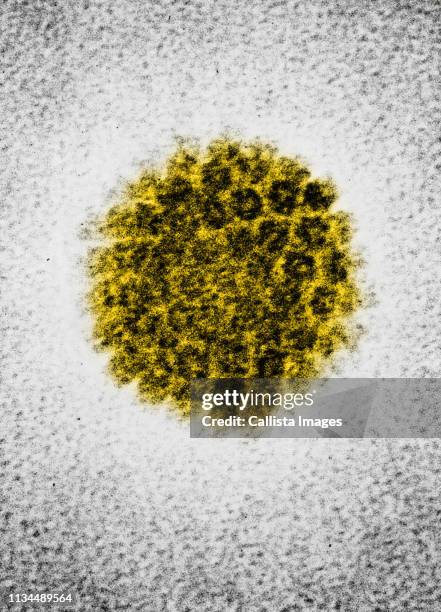 em of a human papilloma virus (hbv) - human papilloma virus ストックフォトと画像