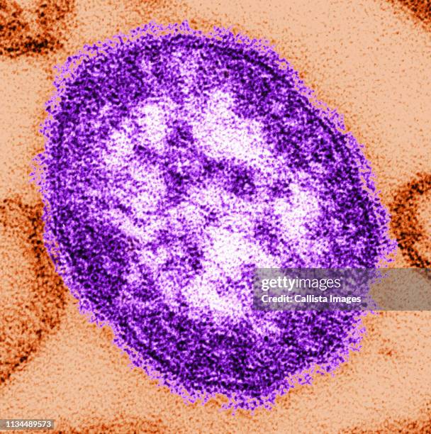 tem of a single measles virus particle or virion - tem 個照片及圖片檔