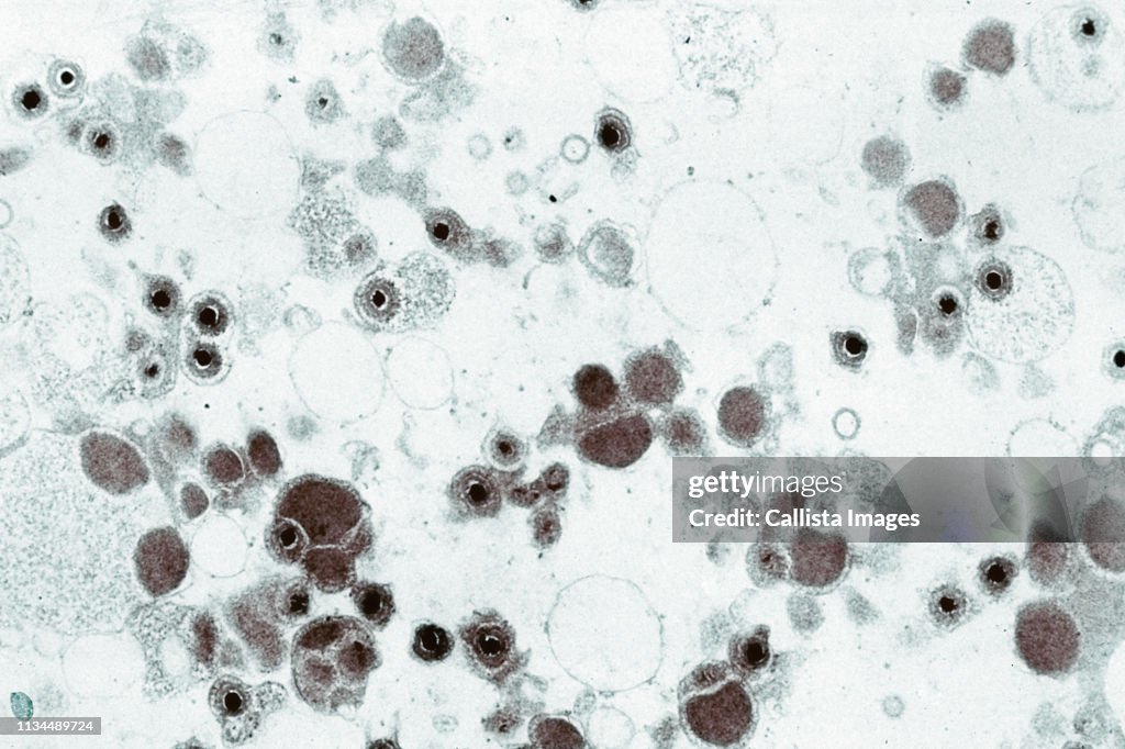 Electron microscope image of cytomegalovirus