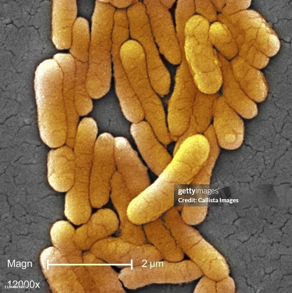 SEM of Salmonella typhimurium bacteria