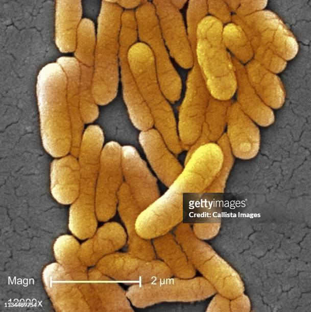 sem of salmonella typhimurium bacteria - salmonella stock pictures, royalty-free photos & images