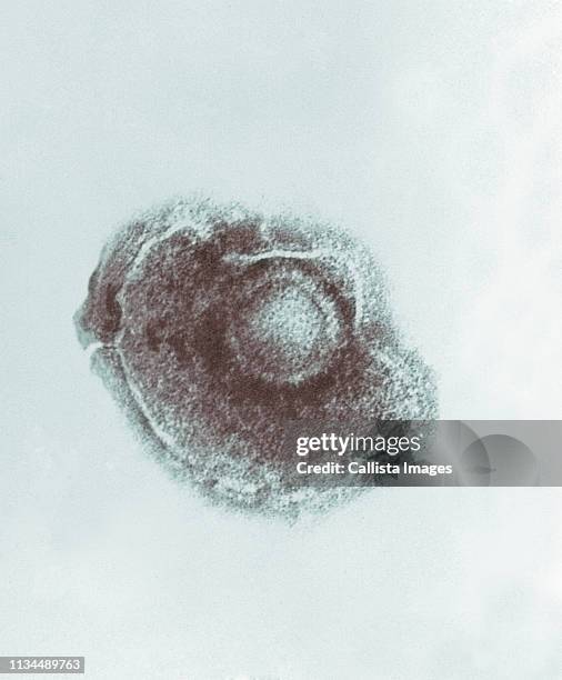 electronmicrograph of varicella chickenpox virus. - electron microscope micrographs stock pictures, royalty-free photos & images