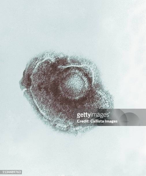 electronmicrograph of varicella chickenpox virus. - bältros bildbanksfoton och bilder