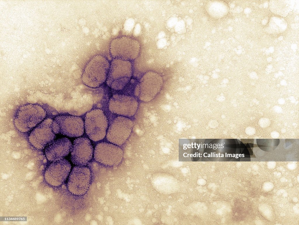 EM image variola (smallpox) viruses