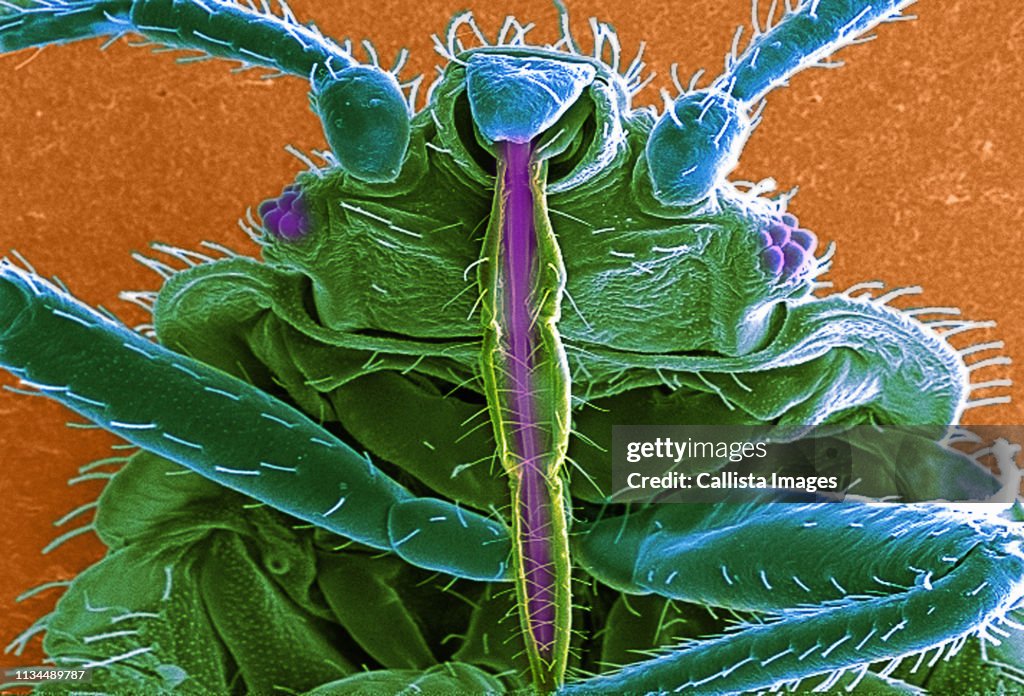 SEM of bedbug (Cimex lectularius)