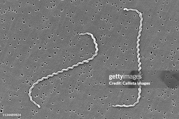 sem of leptospira bacteria - leptospira stock pictures, royalty-free photos & images