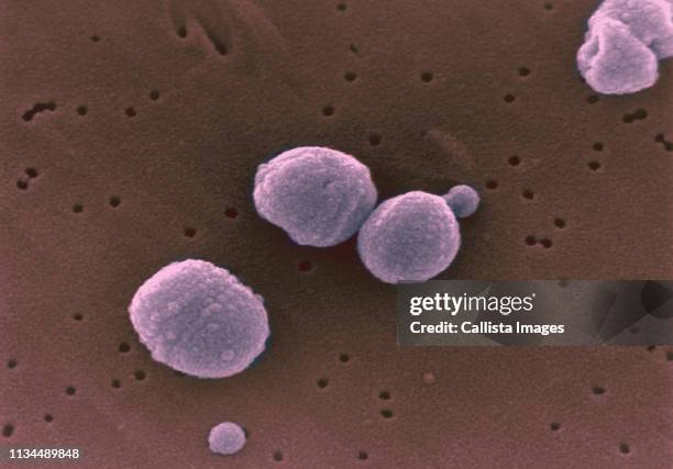 sem of strep pneumonia - streptococcus stock pictures, royalty-free photos & images