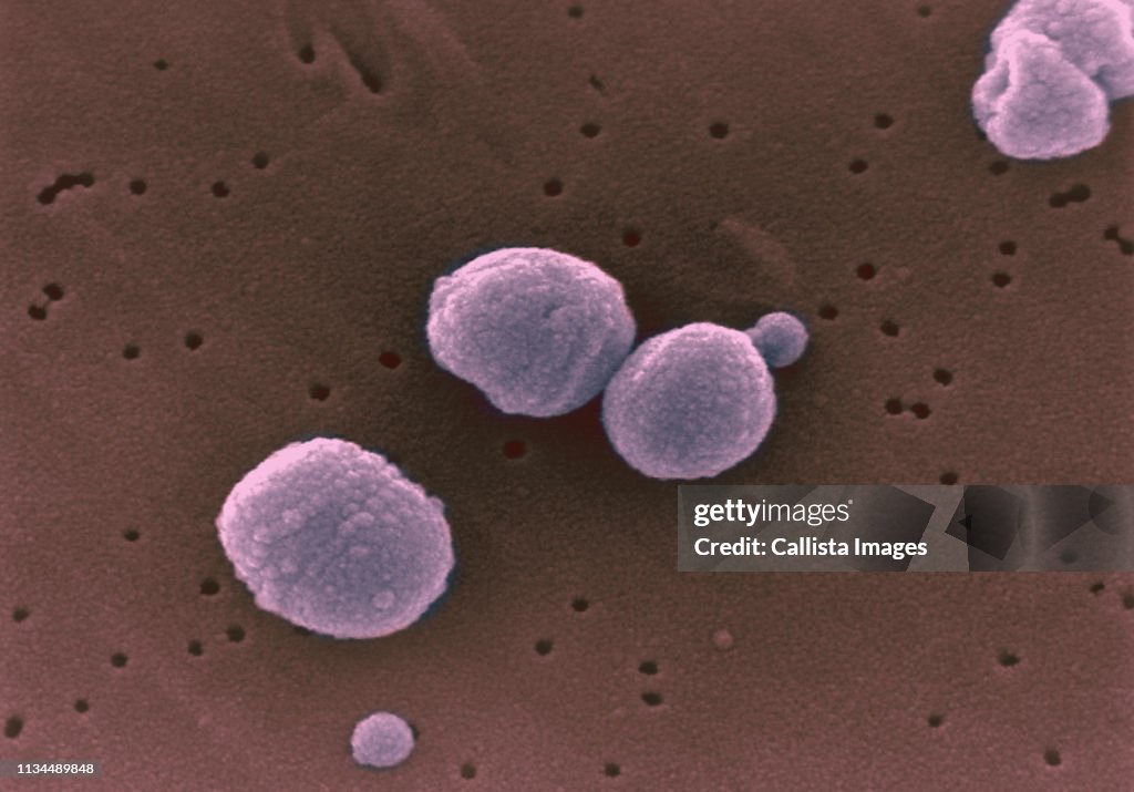 SEM of strep pneumonia