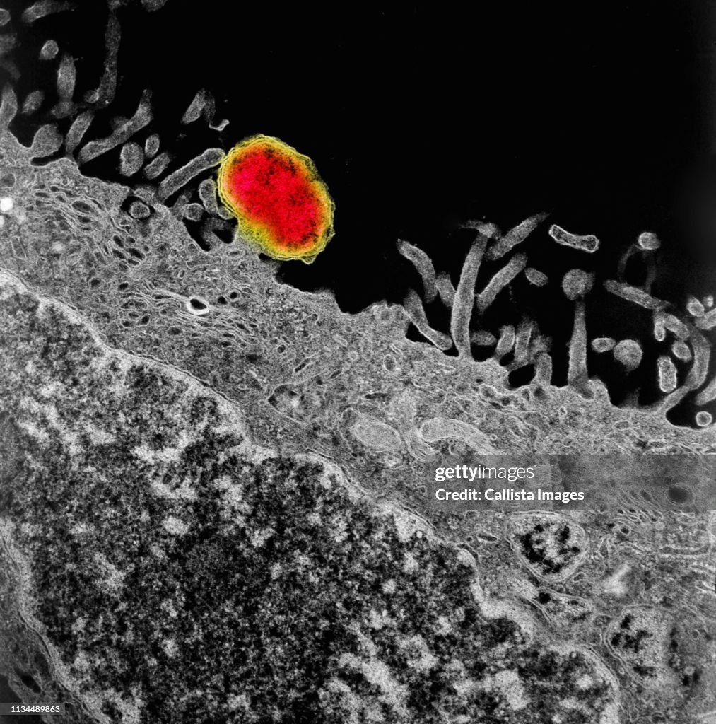 TEM of budding Orientia tsutsugamushi rickettsia