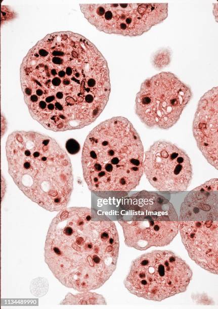 tem image of human platelets - platelet ストックフォトと画像