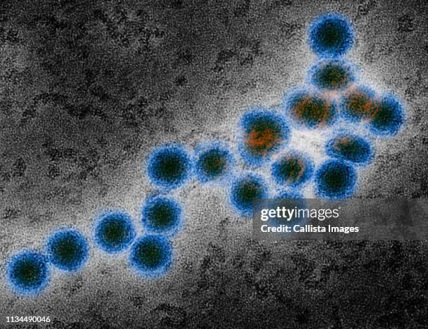 em of west nile virus - west nile virus stock pictures, royalty-free photos & images