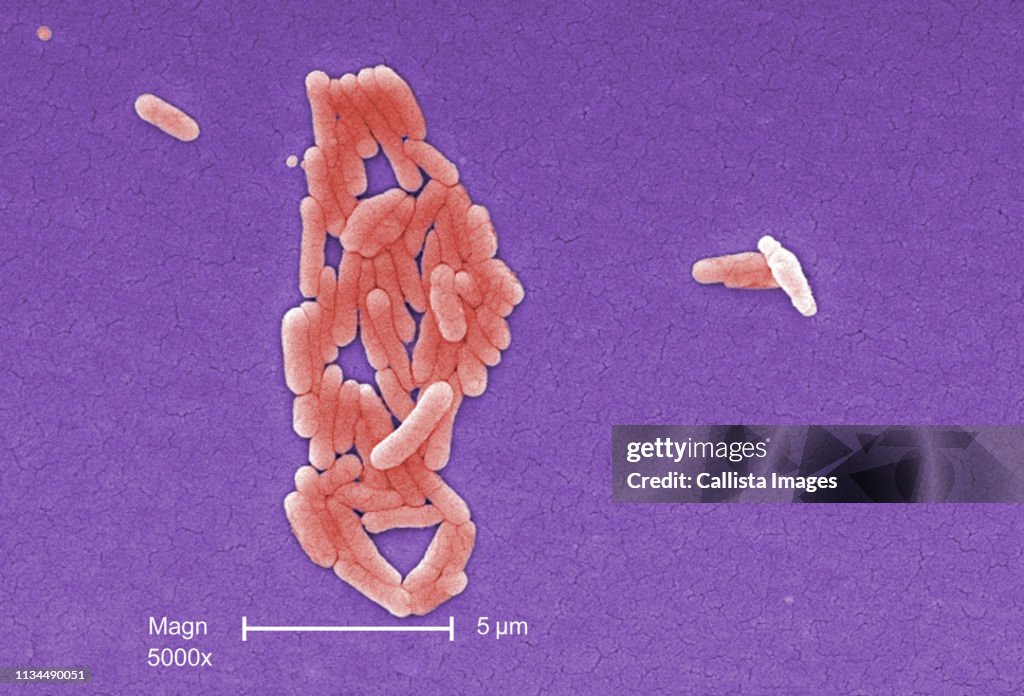 SEM of Salmonella typhimurium bacteria