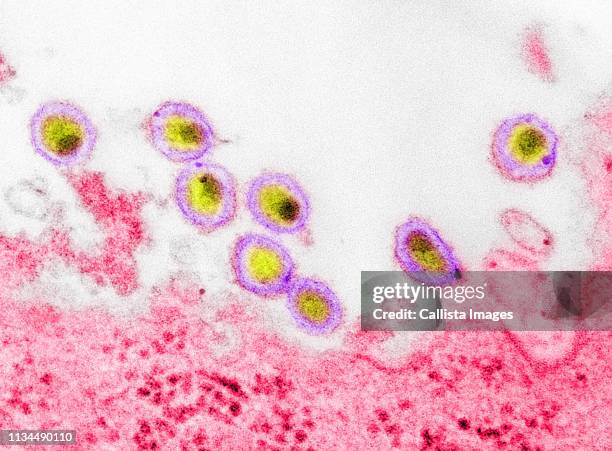 transmission electron micrograph of aids, hiv-1 - electron micrograph stock pictures, royalty-free photos & images