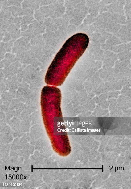 sem of salmonella typhimurium bacterium - salmonellen stock-fotos und bilder
