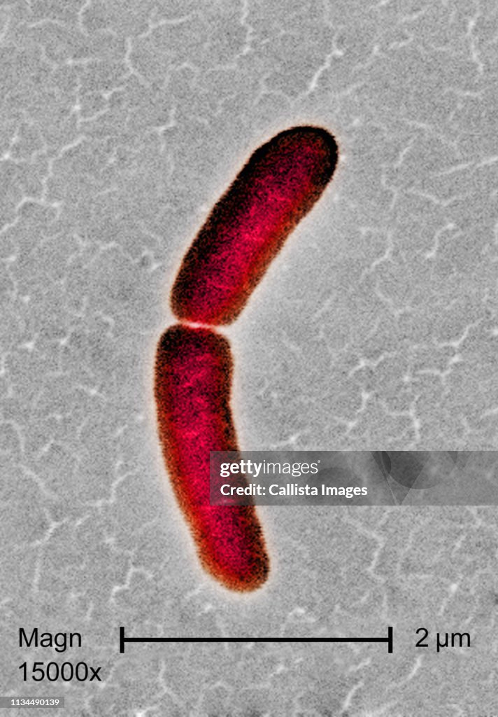SEM of Salmonella typhimurium bacterium
