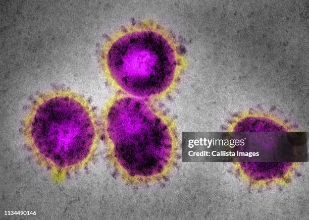 em coronavirus, causing sars - severe acute respiratory syndrome fotografías e imágenes de stock