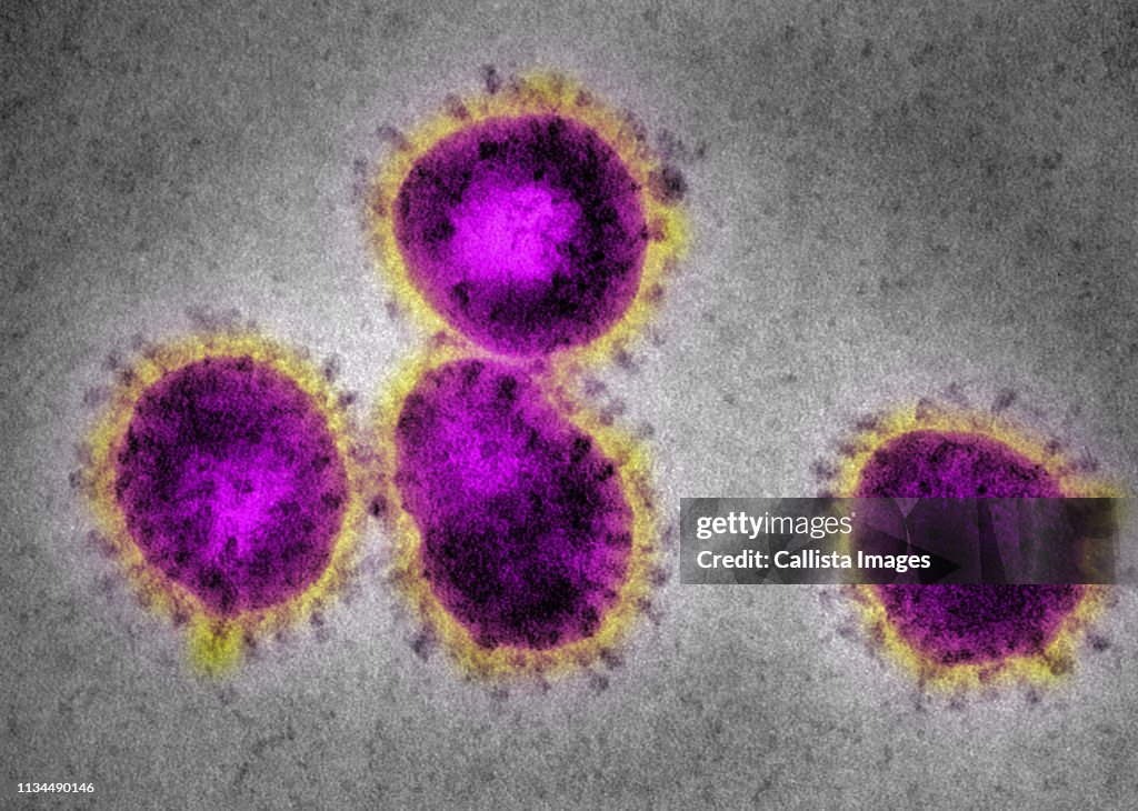 EM Coronavirus, causing SARS