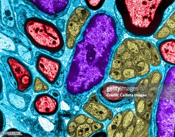 tem of nerve in mouse lung - myelin sheath stock pictures, royalty-free photos & images