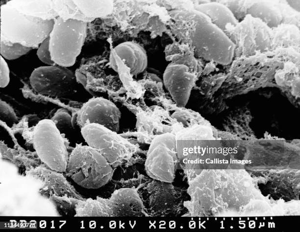 sem of plague bacteria - sem stock pictures, royalty-free photos & images