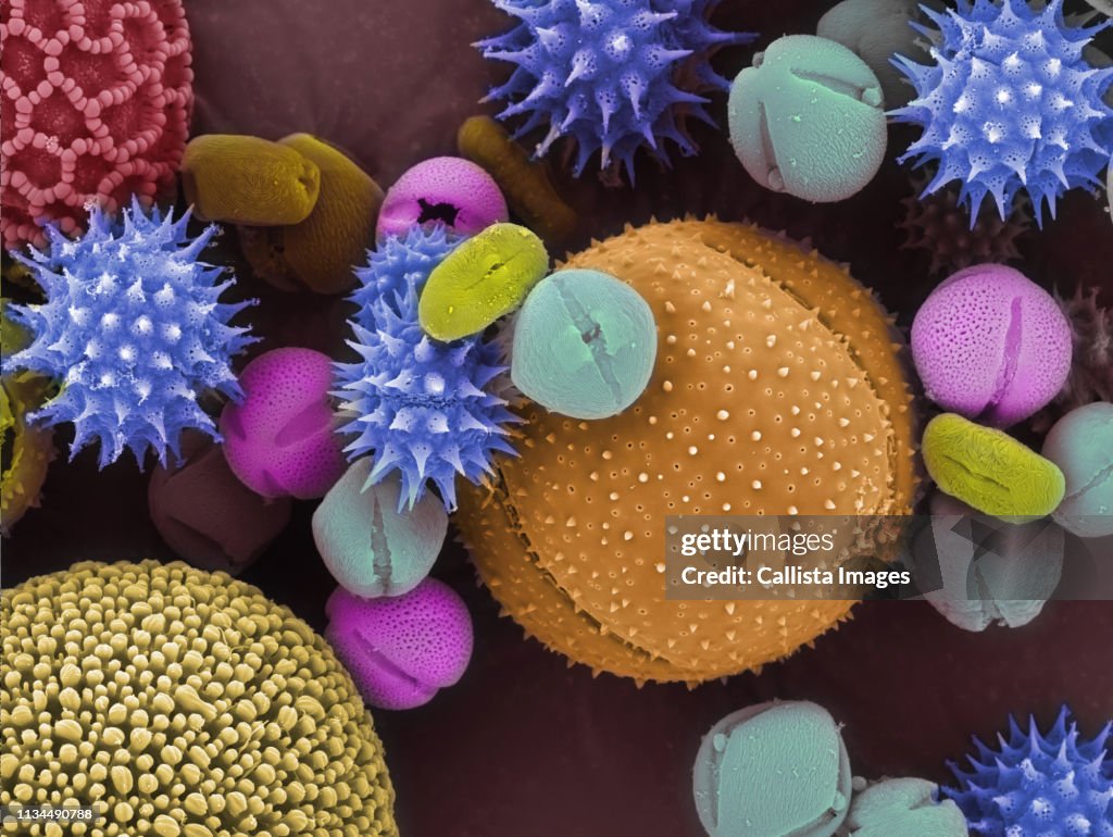 SEM of pollen grains.