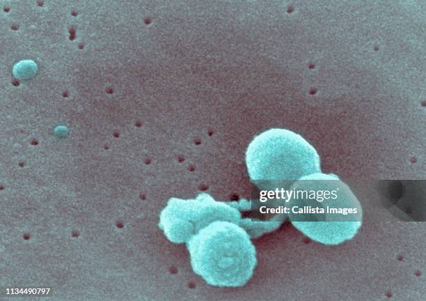 sem of strep pneumonia - streptococcus stock-fotos und bilder