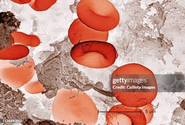 sem showing rbcs and fibrin - fibrin fotografías e imágenes de stock