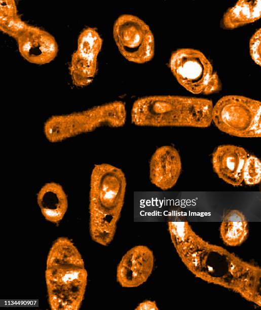 tem of anthrax bacteria (bacillus anthracis) - anthrax bildbanksfoton och bilder