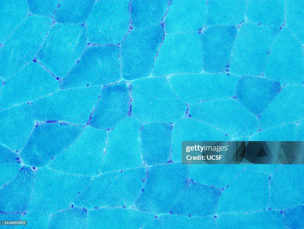 Normal muscle, trichome