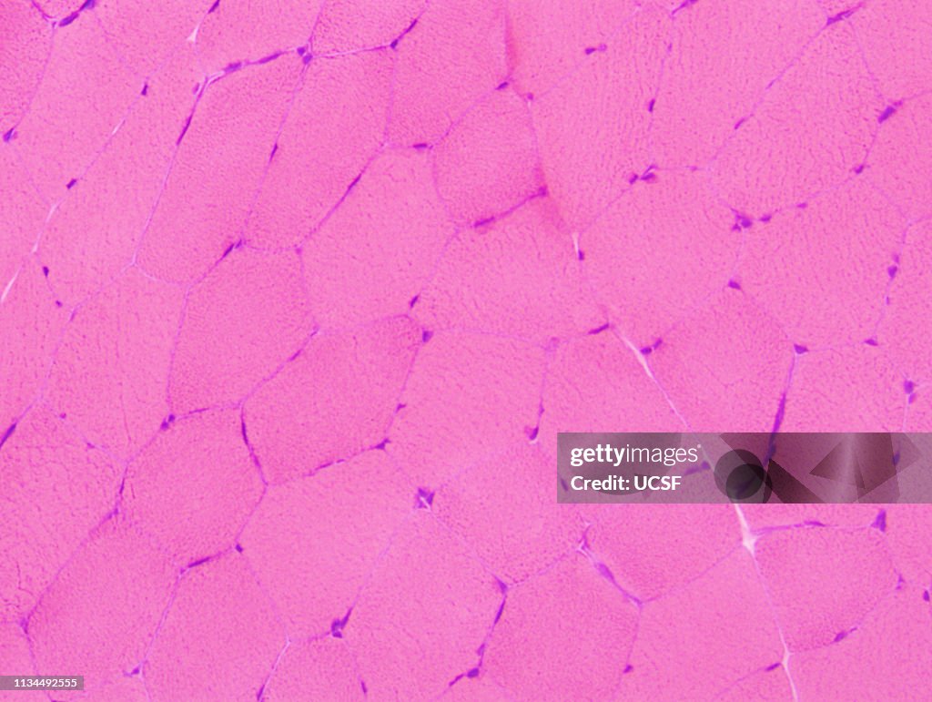 Normal muscle