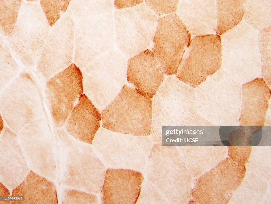 Normal muscle fibers