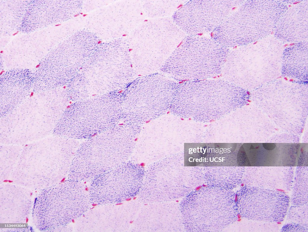 Normal muscle fibers, mitochondria