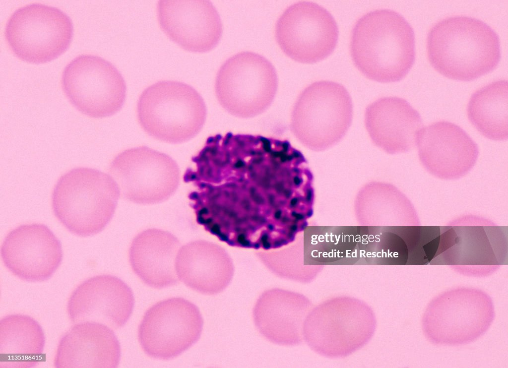 Basophil Cell Example Basophil Under Microscope