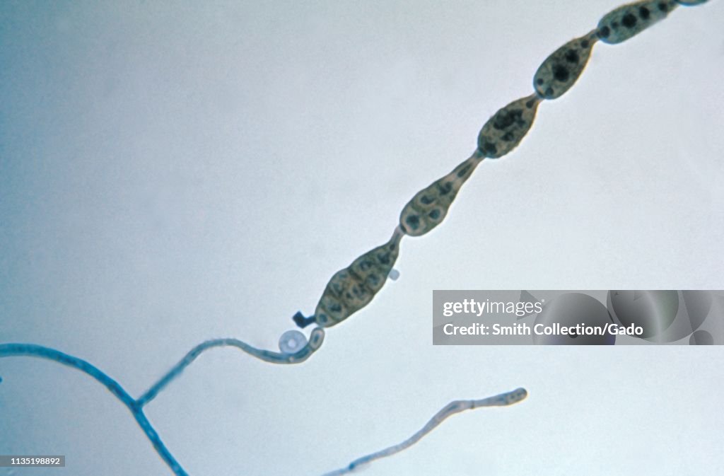 Alternaria Fungus